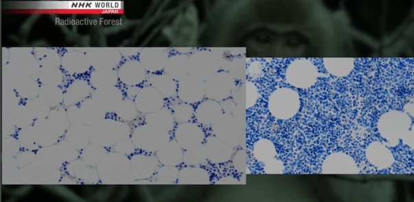 Bone marrow comparison